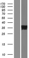 Constitutive androstane receptor (NR1I3) Human Over-expression Lysate