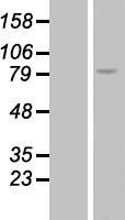 RGS9 Human Over-expression Lysate