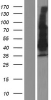 MAGEA9 (MAGEA9B) Human Over-expression Lysate