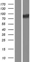 Calpastatin (CAST) Human Over-expression Lysate