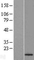 CENPA Human Over-expression Lysate