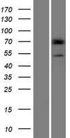 PRAMEF14 Human Over-expression Lysate