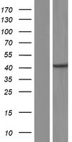 CENPN Human Over-expression Lysate