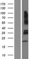 VSIG4 Human Over-expression Lysate