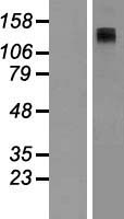 ADCY8 Human Over-expression Lysate