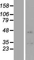 CHAD Human Over-expression Lysate