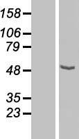 CPN1 Human Over-expression Lysate