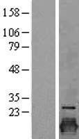Claudin 3 (CLDN3) Human Over-expression Lysate