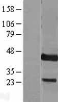 DUSP9 Human Over-expression Lysate