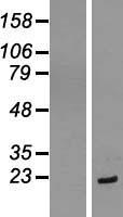 eIF1A (EIF1AX) Human Over-expression Lysate