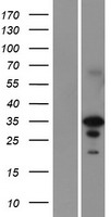 EN2 Human Over-expression Lysate