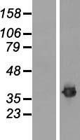 Fibrillarin (FBL) Human Over-expression Lysate