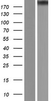 EP300 Human Over-expression Lysate