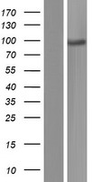 ADAM2 Human Over-expression Lysate