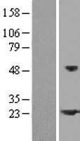 HSPB2 Human Over-expression Lysate
