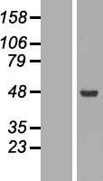 ACADSB Human Over-expression Lysate