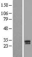 Prostate Specific Antigen (KLK3) Human Over-expression Lysate