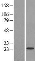 ARF4L (ARL4D) Human Over-expression Lysate