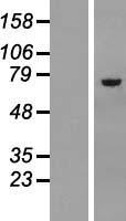 Asparagine synthetase (ASNS) Human Over-expression Lysate