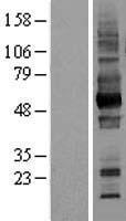 CD147 (BSG) Human Over-expression Lysate
