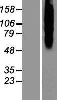 Calcitonin receptor (CALCR) Human Over-expression Lysate