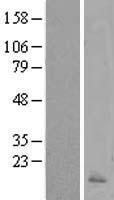 Calcitonin (CALCA) Human Over-expression Lysate