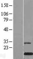 Galectin 10 (CLC) Human Over-expression Lysate