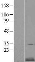 CKS2 Human Over-expression Lysate