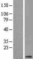CLPS Human Over-expression Lysate