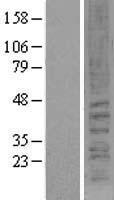Cannabinoid Receptor II (CNR2) Human Over-expression Lysate