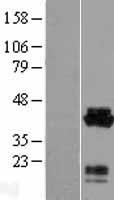 Acidic Calponin (CNN3) Human Over-expression Lysate