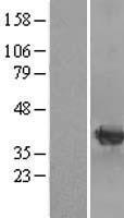 mu Crystallin (CRYM) Human Over-expression Lysate