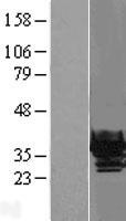 beta B1 Crystallin (CRYBB1) Human Over-expression Lysate