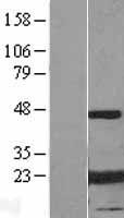 Alpha B Crystallin (CRYAB) Human Over-expression Lysate