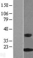 CRABP2 Human Over-expression Lysate
