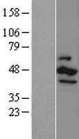 CK1 epsilon (CSNK1E) Human Over-expression Lysate