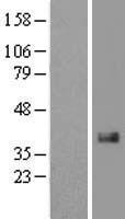 CCN2 Human Over-expression Lysate