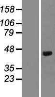 Decorin (DCN) Human Over-expression Lysate