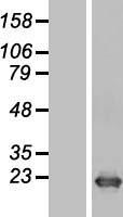 DR1 Human Over-expression Lysate