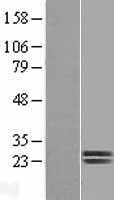 Dermatopontin (DPT) Human Over-expression Lysate