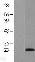 Endothelin 2 (EDN2) Human Over-expression Lysate