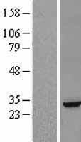 Ephrin A5 (EFNA5) Human Over-expression Lysate