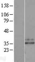Neutrophil Elastase (ELANE) Human Over-expression Lysate