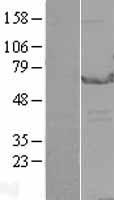 EPHX2 Human Over-expression Lysate