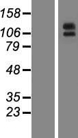 Aminopeptidase A (ENPEP) Human Over-expression Lysate