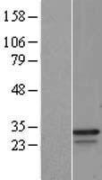 GAPDH Human Over-expression Lysate
