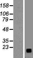 Gastrin Releasing Peptide (GRP) Human Over-expression Lysate