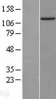 SMUBP2 (IGHMBP2) Human Over-expression Lysate