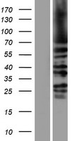 KIFC1 Human Over-expression Lysate