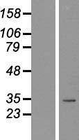Nkx2.2 (NKX2-2) Human Over-expression Lysate